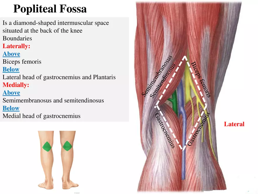 <p>Superomedial → semimembranosus & semitendinosus</p><p>Superolateralateral → biceps femoris</p><p>Inferomedial → medial head of gastrocnemius</p><p>Inferolateral → lateral head of gastrocnemius, plantaris</p><p>Floor → knee joint capsule, distal femur, proximal tibia, popliteus muscle</p><p>Roof → popliteal fascia</p>