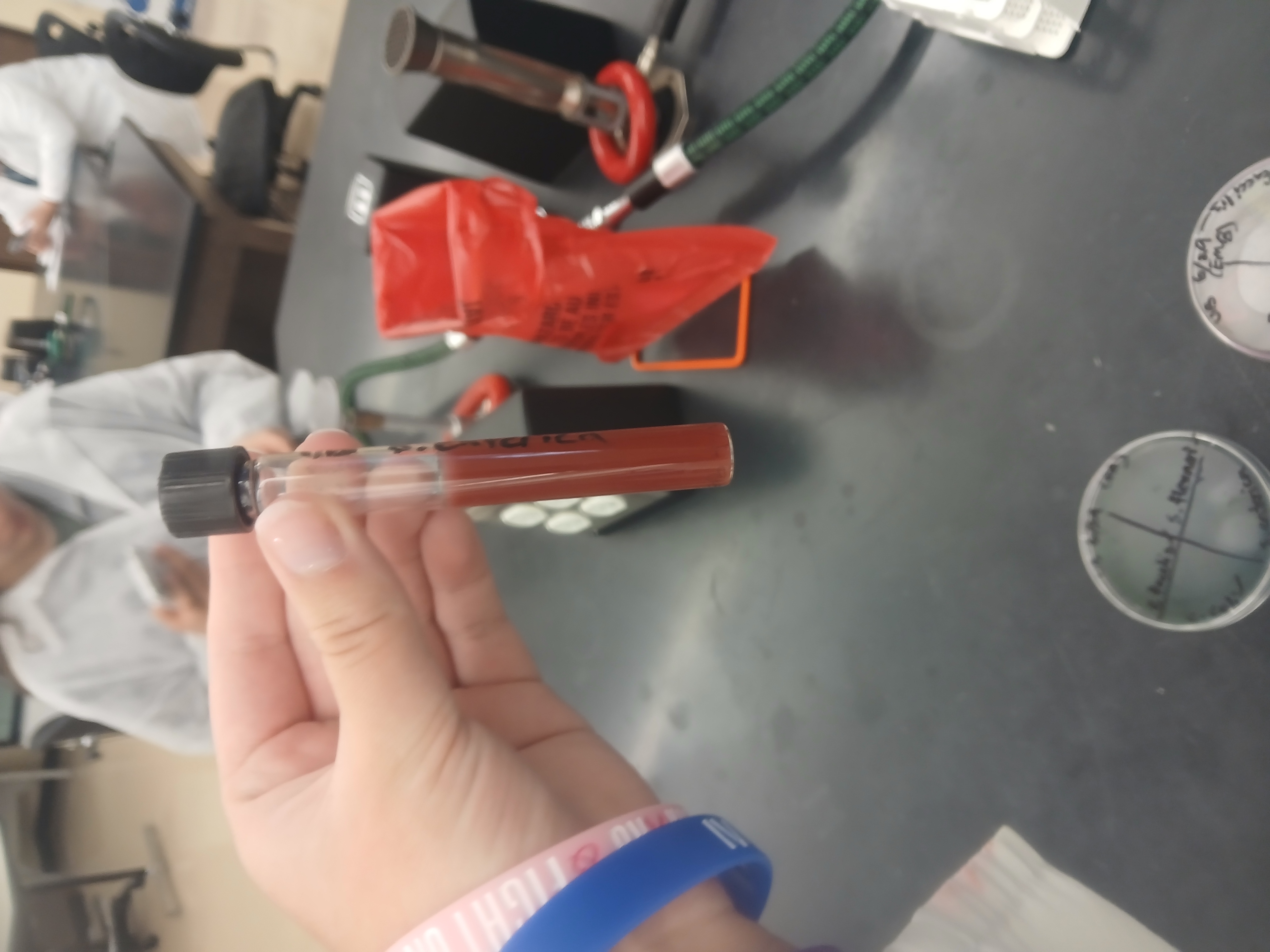 <p>The bacterial growth spreads outward from the central stab line, creating a cloudy, hazy, or "diffuse" zone of growth that may fan out through the entire tube. [1, 2]</p>
