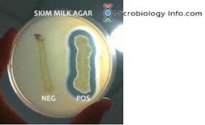 <p>Skim milk agar test</p>
