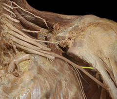 <p>Identify the structure</p>