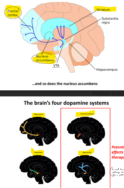 <p><strong><u>antipsychotics</u></strong> — are used to manage <u>psychosis (positive </u>symptoms) in <u>SCZ & bipolar disorder</u></p><ul><li><p><u>typical </u>antipsychotics — 1st gen drugs that <u>block dopamine </u><strong><u>D2 </u></strong><u>Rs</u></p><ul><li><p>ex: <strong>Haldol, Thorazine</strong></p></li></ul></li><li><p><u>atypical </u>antipsychotics — 2nd drugs that <u>block BOTH </u><strong><u>DA </u></strong><u>Rs & </u><strong><u>serotonin </u></strong><u>Rs</u></p><ul><li><p>ex: <strong>clozapine</strong></p></li></ul></li></ul><p>__</p><p><u>D1 and D2</u> dopamine Rs</p><p>all DA Rs are <u>metabotropic</u></p><p>__</p><ul><li><p><strong><u>nigrostriatal </u></strong>pathway — DA from SN (substantia nigra) → striatum</p><ul><li><p><u>motor </u>pathways</p></li></ul></li><li><p><strong><u>mesocortical </u></strong>pathway — DA from VTA (ventral tegmental area) → cortical areas, like prefrontal cortex (PFC)</p><ul><li><p><u>cognition</u></p></li></ul></li><li><p><strong><u>mesolimbic </u></strong>pathway — DA from VTA → nucleus accumbens</p><ul><li><p><span style="color: red;"><u><mark data-color="red" style="background-color: red; color: inherit;">reward-seeking behavior & motivation</mark></u></span></p></li></ul></li><li><p><strong><u>tuberoinfundibular </u></strong>pathway — DA from <u>hypothalamus → pituitary</u></p><ul><li><p><strong>normally </strong>reduces <u>hormone </u>release, which reduces <u>lactation</u></p></li></ul></li></ul><p>^<u> mesocortical & mesolimbic pathways </u>rel. to SCZ and mood disorders</p><ul><li><p>SO for treatment, we would want to <u>suppress the tuberoinfundibular & nigrostriatal pathways W/O affecting the 2 meso- pathways</u></p></li></ul><p></p>