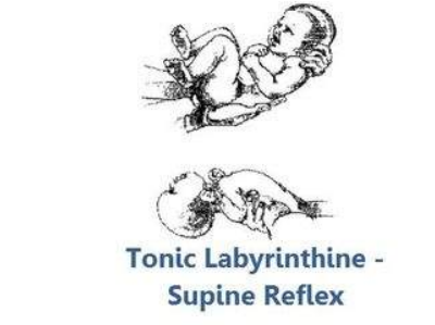 <ul><li><p>head flexed forward- flexors stimulate</p></li><li><p>head tilted back- extensors stimulate</p></li></ul><p>prior to motor control, these are reflexive responses</p><p></p>