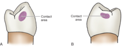 <p>contact area</p>