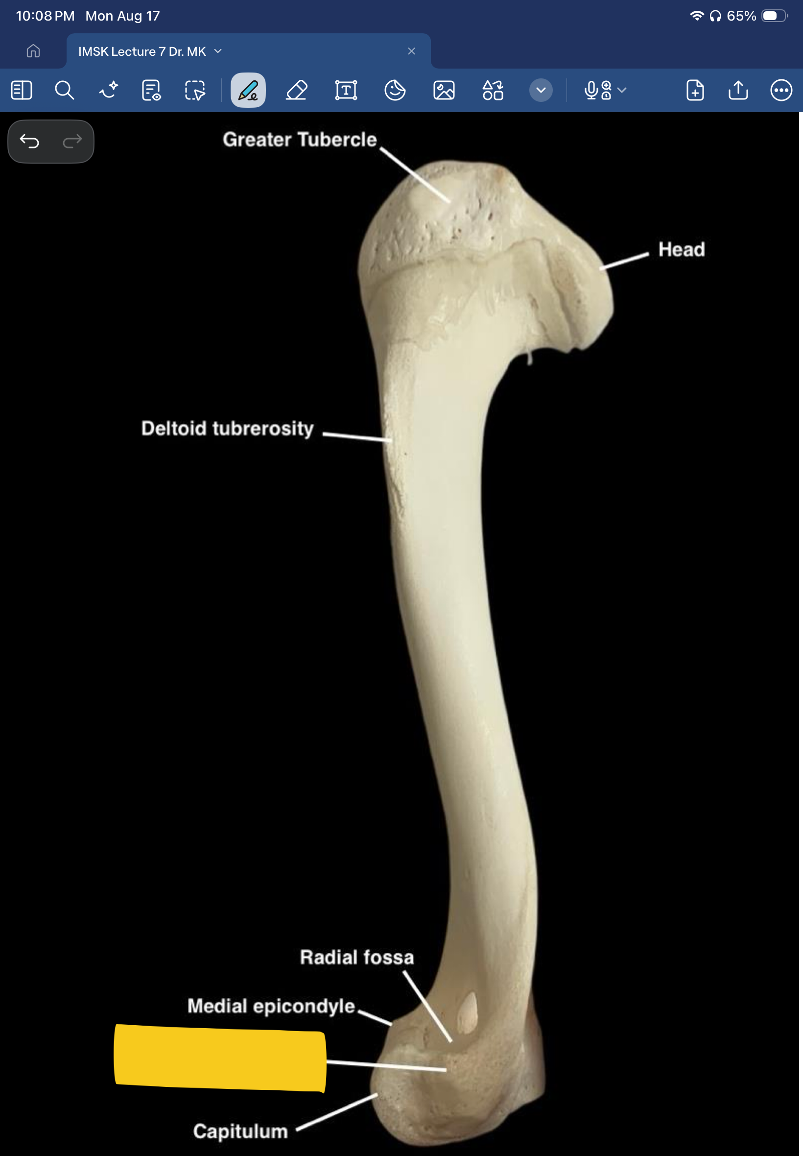 term image
