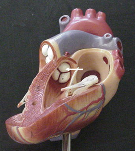 <p>Directs flow from the left ventricle to the Aorta</p>