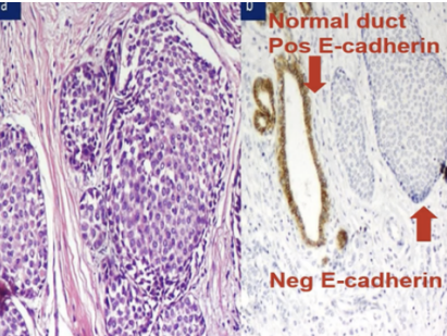 <p>What pathology?</p>