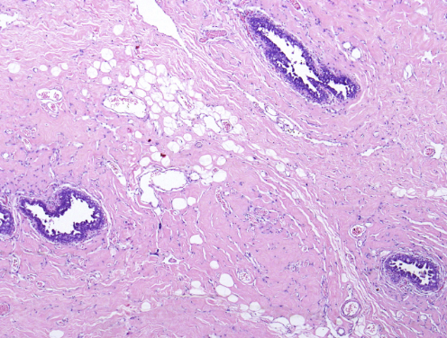 <p>Sein, homme </p><p>1) diagnostic</p><p>2) définition </p>
