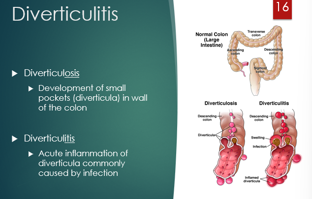 <p>diverticulosis - small pockets develop in wall of colon</p><p>“ “ itis - acute inflammation of diverticula caused by infection</p><p></p>