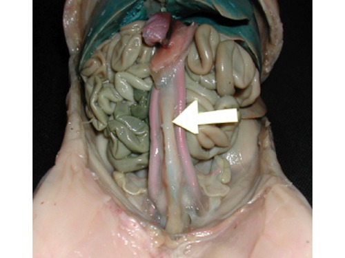 <p><span>Urinary Bladder</span></p>