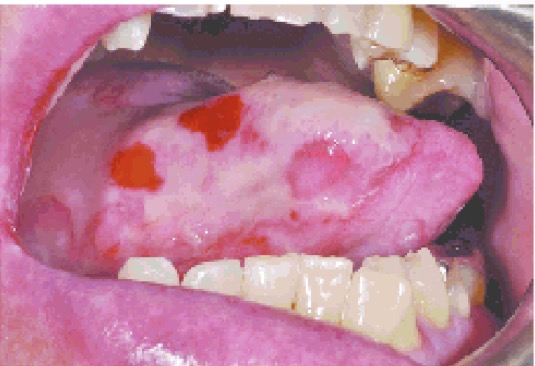 <p>CHẨN ĐOÁN?</p>