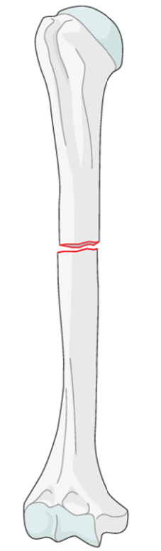 <p>Simple</p>