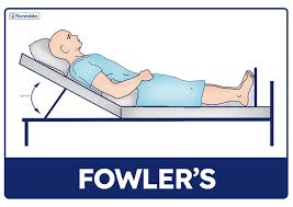 <p>Fowler’s position?</p>