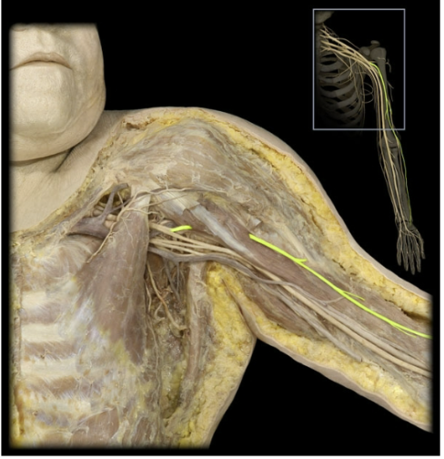 <p>What’s the spinal level of the musculocutaneous nerve?</p>
