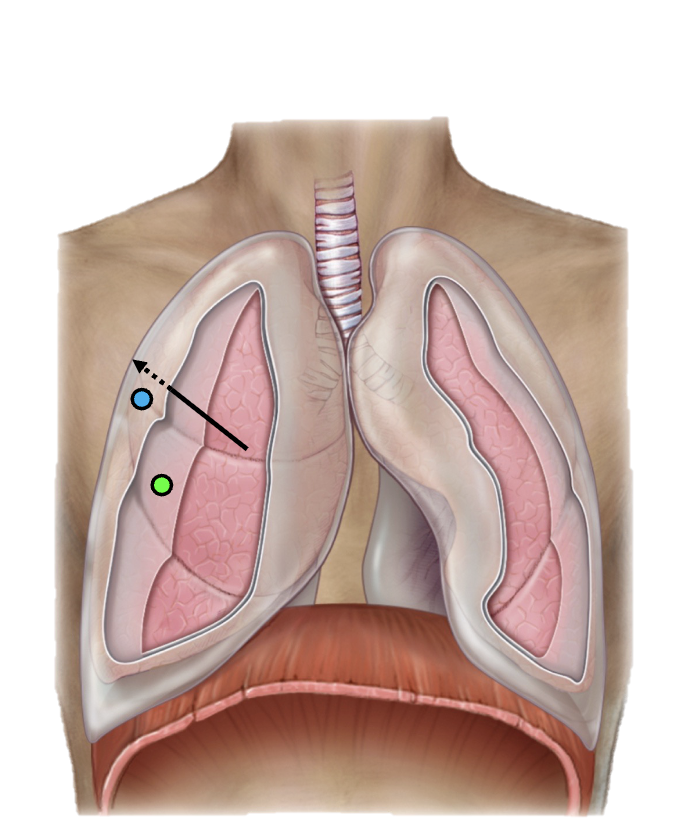 <p>visceral pleura</p>