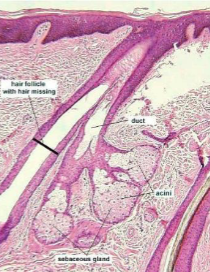 <p>Sebaceous Glands</p>
