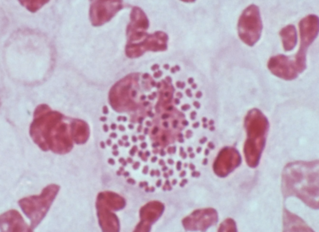 <p><span>Your patient is experiencing fever, chills, an intense headache, and a stiff neck. The following image shows what was seen upon Gram stain of their cerebrospinal fluid. What is the causative agent?</span></p>