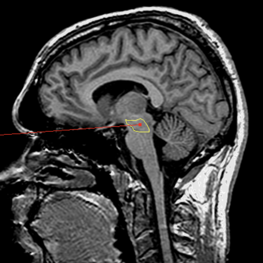 <p>What is the area highlighted called?</p>