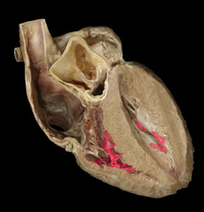 <p>Identify the structure</p>