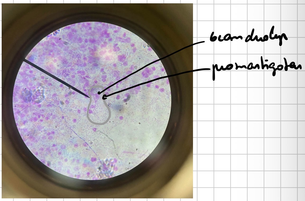 <p>Leišmanija - leishmania (promastigotai)</p>