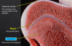 <p>the cartilage on the articular surface of the epiphysis. This cartilage remains even into adulthood.</p>