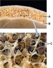 <p>supporting bundles of bony fibers in cancellous bone</p>