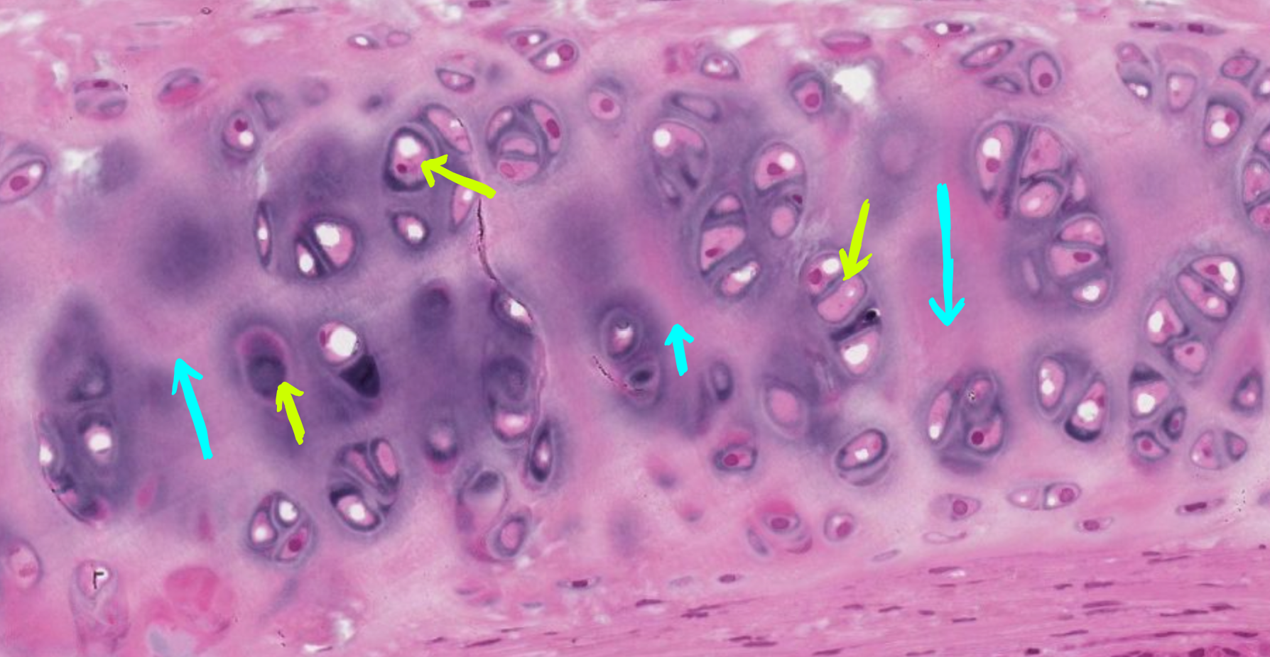 <p>What are the yellow arrows pointing to in the slide? (Monkey Trachea)</p>