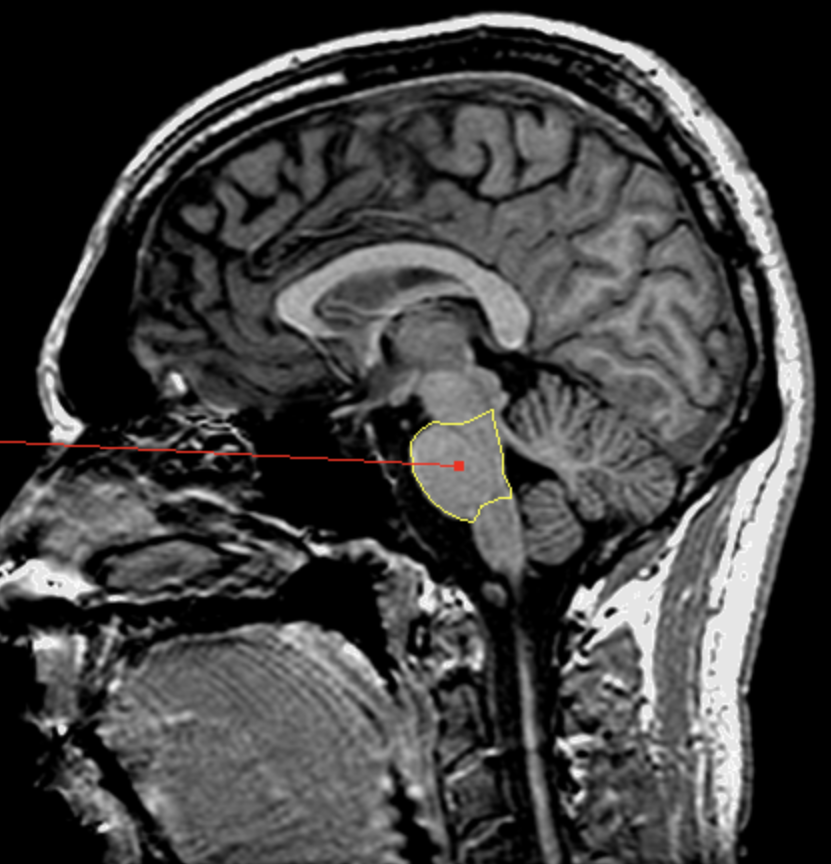 <p>What is the area highlighted called?</p>