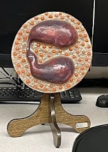 <p>What blood cell model is this?</p>