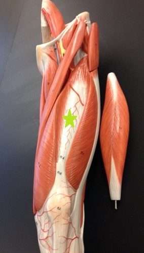 <p>What muscle is this?</p>