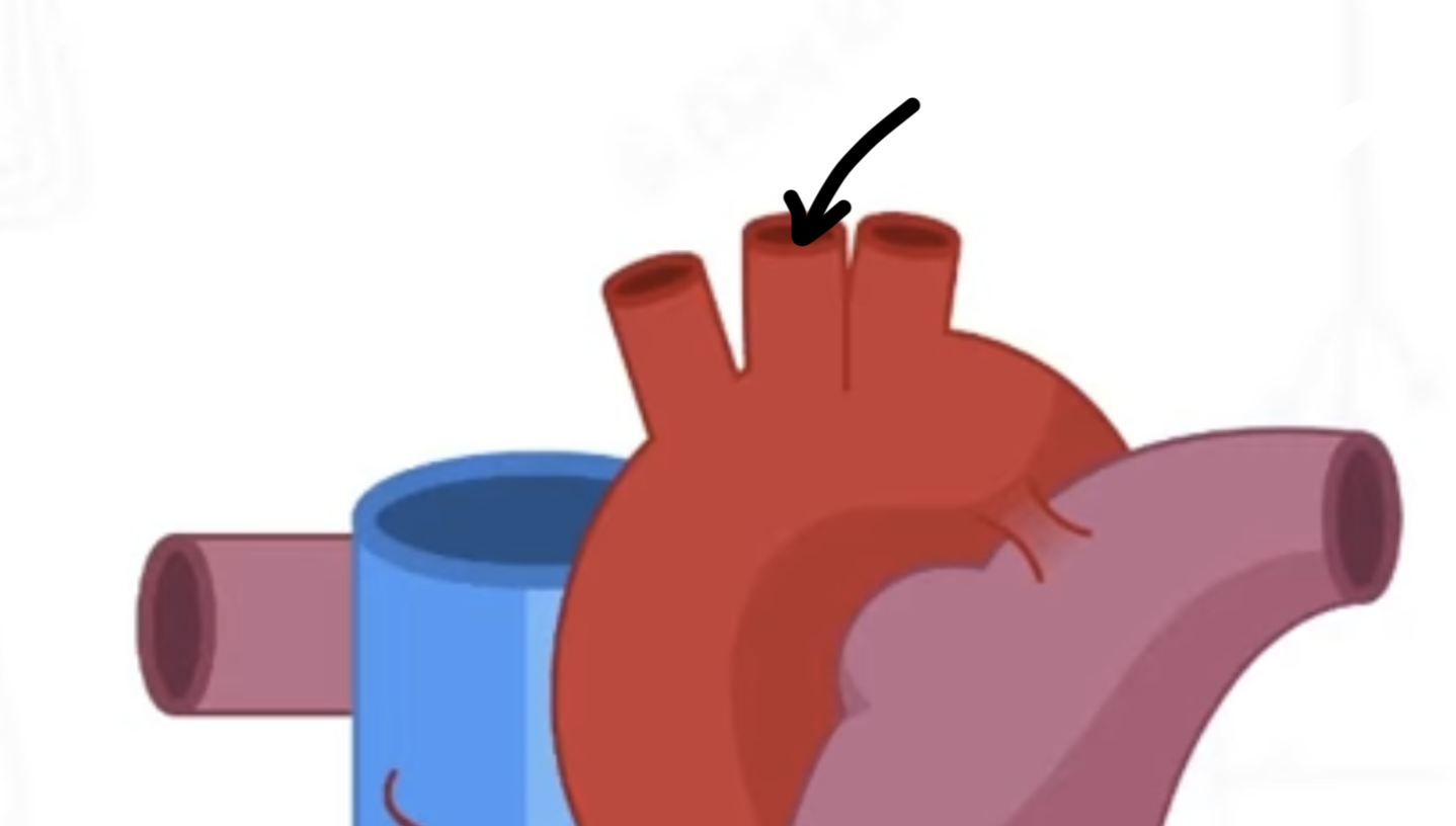 <p>middle vessel on the aortic arch</p>