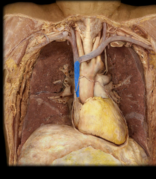 <p>L and R brachiocephalic veins</p>