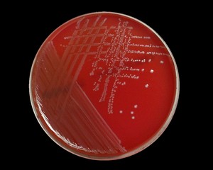 <p><strong>No growth</strong> or tiny pinpoint colonies</p><p></p><p>Dyes (eosin and methylene blue) are toxic and inhibit Gram-positive organisms.</p>
