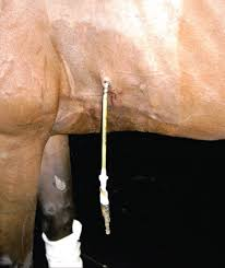 <p>where would you insert needle for thoracocenthesis (pleurocentesis)?</p>