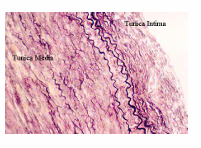 <p>fenestrated sheet of elastin that allows the transport of H2O nutrients and electrolytes across the wall as well as direct transmural cell to cell communication </p>