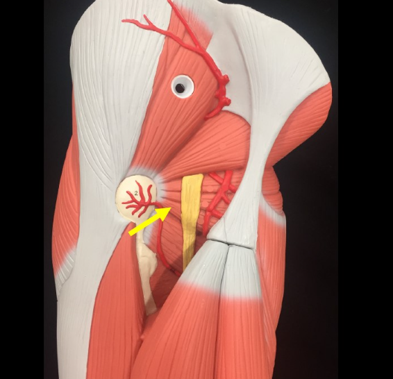 <p>Name the muscle</p>
