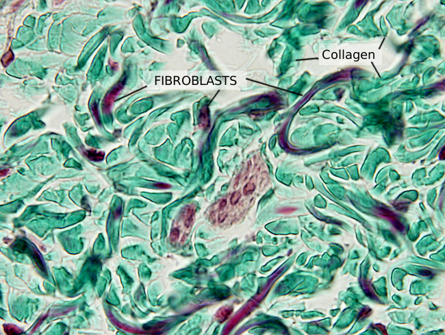 <p>Help create supporting fibers (collagen), overactivity can cause fibrosis (scarring); small, dark, football like shape</p>