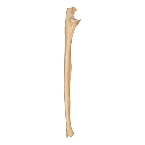 <p>What bone is this?</p>