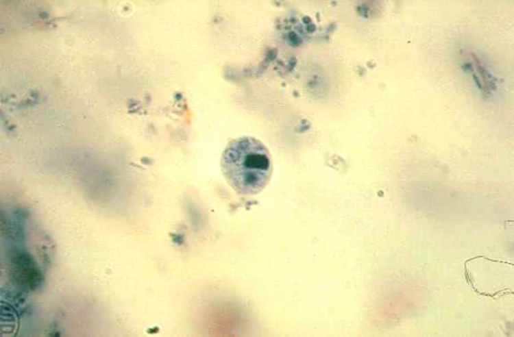 <p><span>8&nbsp;<strong>µm</strong></span></p>