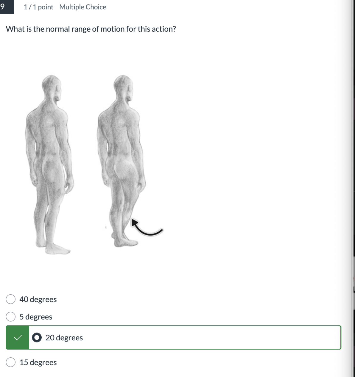 <p>What is the normal range of motino for this aciton? </p>