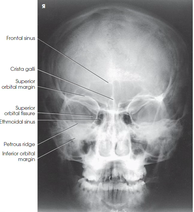 <p>What view is this?</p>