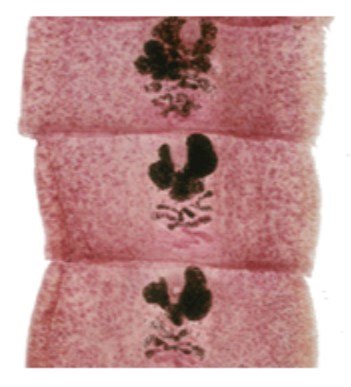 <p>Name</p>