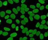 <p>smooth, even glow of the entire nucleus</p>