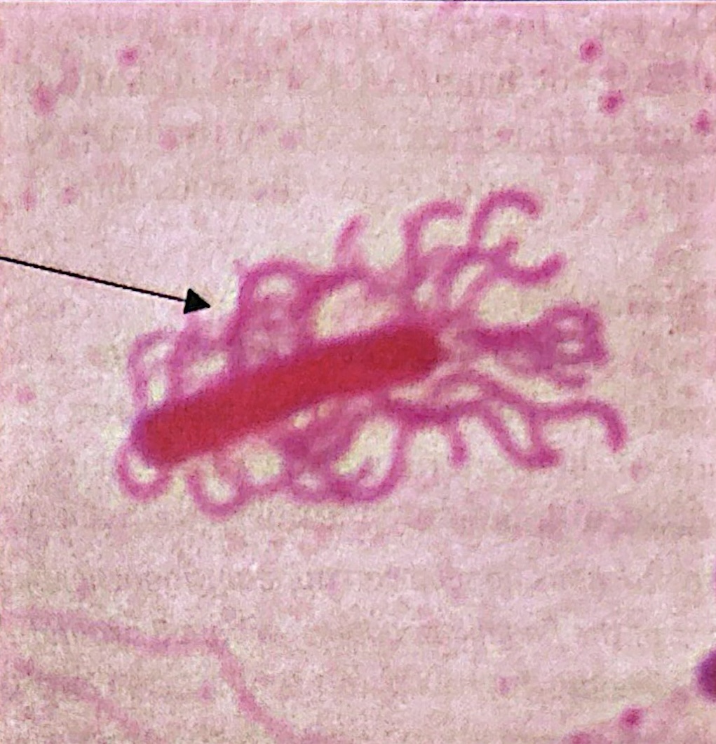 <p>has flagella surrounding the cell</p>