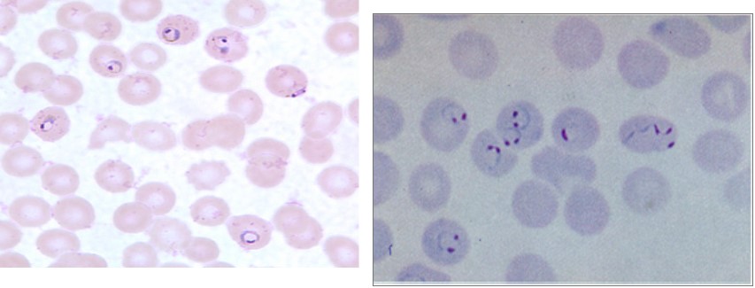 <p>Name; disease; sample; vector</p>