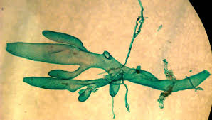 <p>Class: Calcarea - Calcareous sponges </p>