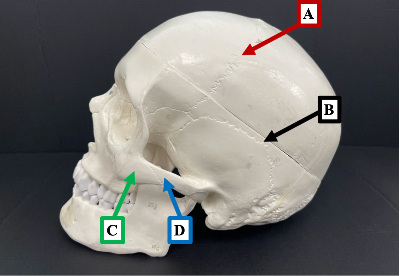 <p>What is the name of the suture that label <strong>A </strong>is pointing to?</p>