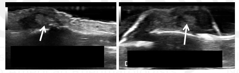 <p>What view is this? What is the arrow?</p>