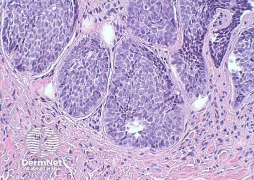 <ol><li><p>Sickle Cell Anemia</p></li><li><p>Atherosclerosis</p></li><li><p>Adenocarcinoma of Kidney</p></li><li><p>Osteogenic Sarcoma of Bone</p></li><li><p>Tattoo in Human Skin</p></li><li><p>Neurilemmoma</p></li><li><p>Anthracosis of the Lung</p></li><li><p>Basal Cell Carcinoma</p></li><li><p>Lung</p></li><li><p>Skeletal</p></li><li><p>Kidney</p></li><li><p>Neuron</p></li><li><p>Skin</p></li><li><p>Blood</p></li><li><p>Bone</p></li><li><p>Aorta</p></li></ol><p></p>