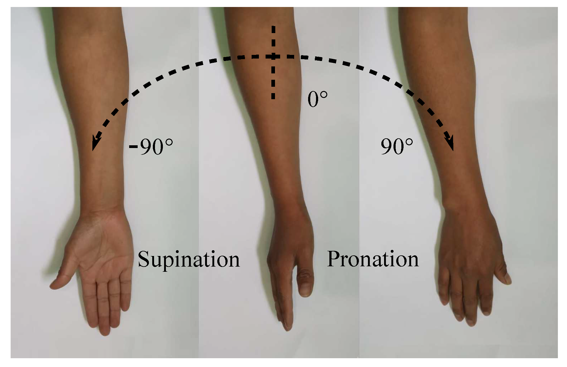 <p>rotation of the forearm so that the palm is up (anatomic position)</p>