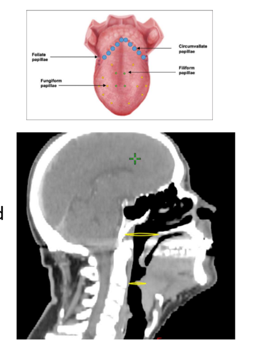<p>what are the anterior, posterior, superior, inferior, and lateral borders of the oropharynx?</p>